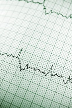 Elektrokardiyogram