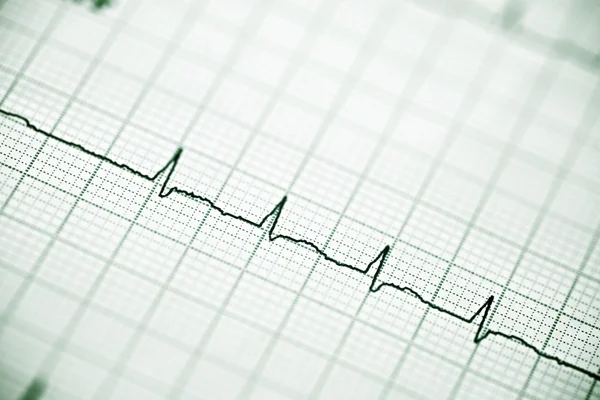 Electrocardiograma —  Fotos de Stock