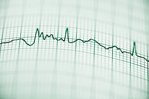 Electrocardiogram — Stock Photo, Image