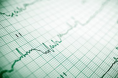 Elektrokardiyogram yakın çekim