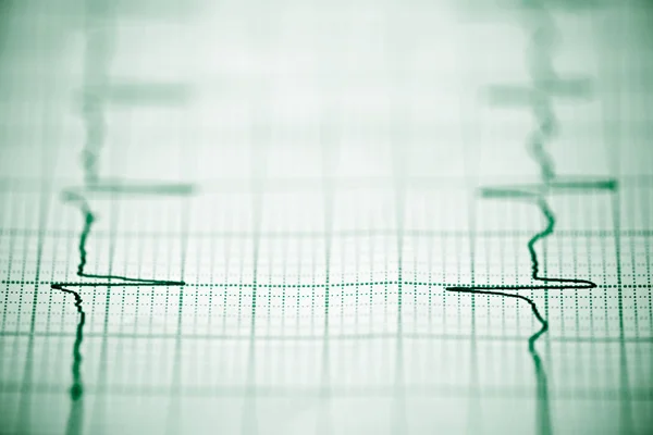 Elektrocardiogram close-up — Stockfoto