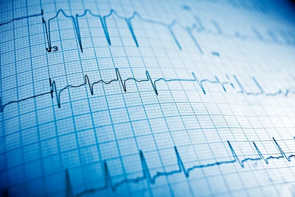 Electrocardiogram close up — Stock Photo, Image