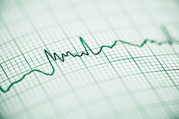 Electrocardiograma de cerca —  Fotos de Stock