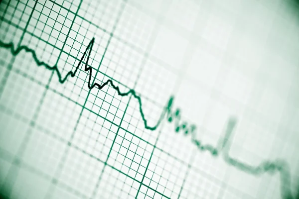 Electrocardiogram close up — Stock Photo, Image