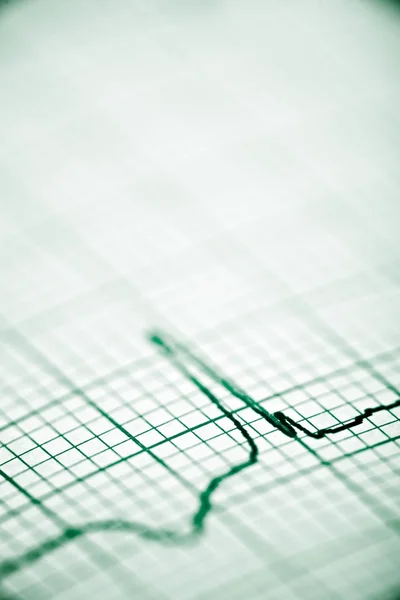 Électrocardiogramme en gros plan — Photo