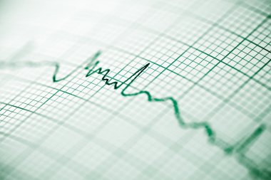 Elektrokardiyogram yakın çekim