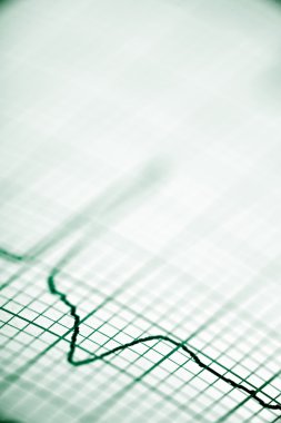 Elektrokardiyogram yakın çekim