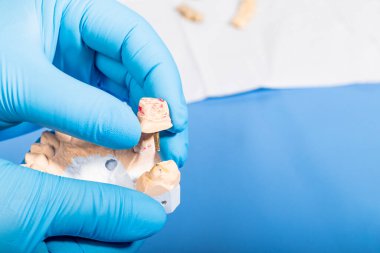 Stüdyo ışıkları. Mavi eldivenli bir adamın çenesi alçıdan. Yakın plan.