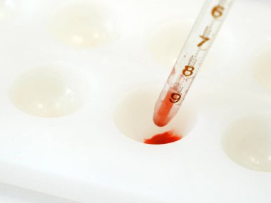 Laboratuvarda kan örnekleriyle test tüpleri, koronavirüs testleri, yakın çekim.