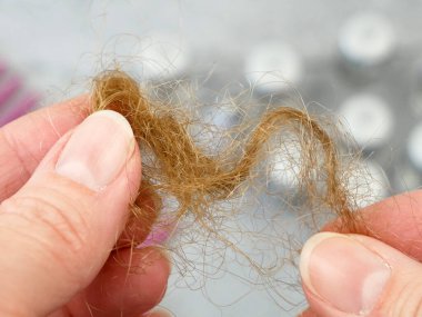 Saç dökülme problemi. İlaç şişeleri, saç fırçası ve saç topuzu. Alternatif tedaviler ilaç şişeleri ve gri arka planda tarak, yakın plan