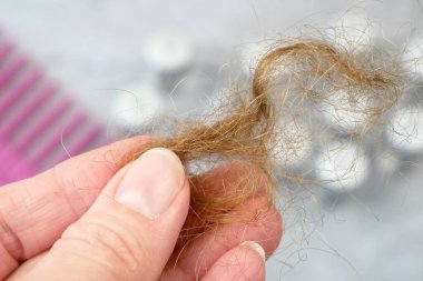 Saç dökülme problemi. İlaç şişeleri, saç fırçası ve saç topuzu. Alternatif tedaviler ilaç şişeleri ve gri arka planda tarak, yakın plan