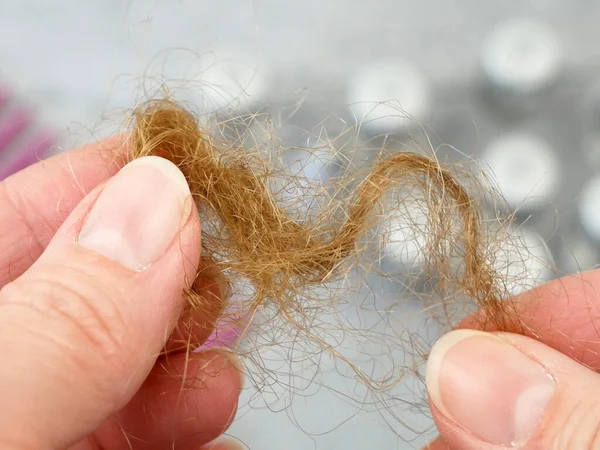 Problème Perte Cheveux Bouteilles Avec Médicament Brosse Cheveux Chignon Traitements — Photo