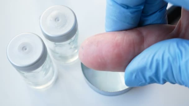 Läkare Inspektera Kvinna Finger Hud Med Förstoringsglas Dermatologi Problem Våren — Stockvideo