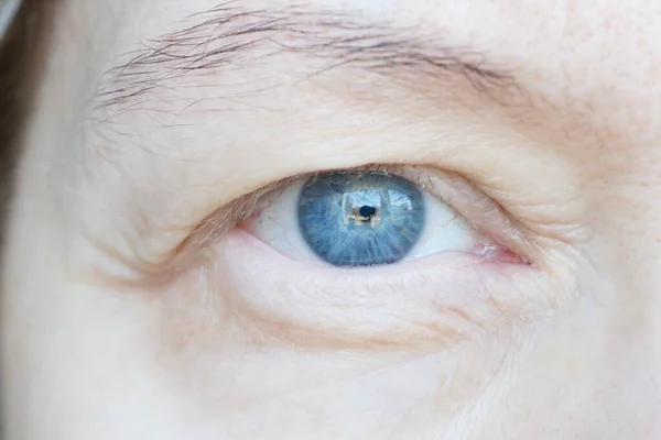 Orta yaşlı kadın gözü ve sarkık göz kapağı. Ptosis, göz kapağının üst kısmının sarkmasıdır, tembel göz. Kozmetik ve yüz konsepti, ilk kırışıklıklar, yakın çekim.