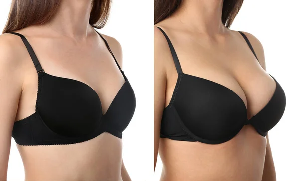 Collage Young Woman Bra Different Sizes Breast White Background Plastic — Stock Photo, Image