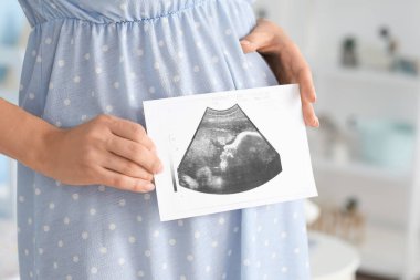 Evinde ultrason görüntüsü olan güzel hamile kadın, yakın plan.