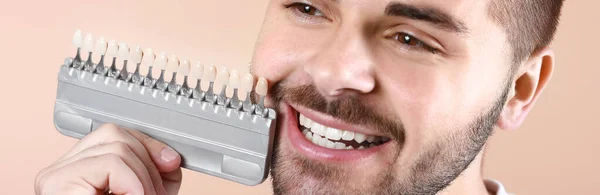 Hombre Joven Con Muestras Color Dientes Sobre Fondo Beige —  Fotos de Stock