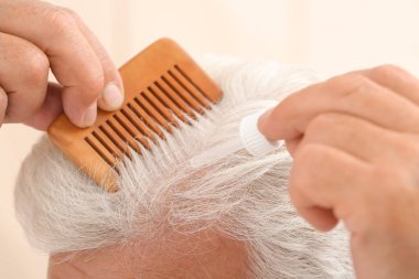 Kıdemli adam saç dökülmesi tedavisi için serum kullanıyor, yakın plan.