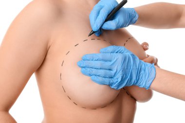 Doktor, beyaz arka plana estetik ameliyat yapılmadan önce kadın göğsüne izler çiziyor.