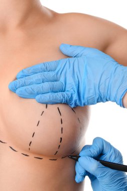 Doktor, beyaz arka plana estetik ameliyat yapılmadan önce kadın göğsüne izler çiziyor.