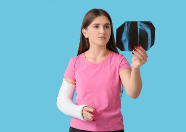 Kırık kollu genç bir kadın. Röntgen görüntüsünü arka planda tutuyor.