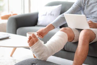 Evde çay içerken dizüstü bilgisayar kullanan kırık bacaklı genç adam.