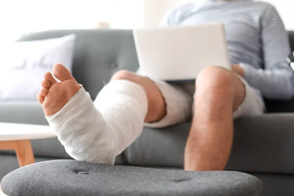 Mladý Muž Zlomenou Nohou Pomocí Notebooku Doma — Stock fotografie