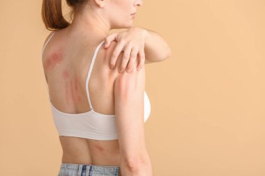 Genç alerjik bir kadın cildini renk arka planına sürtüyor.