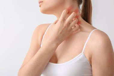 Genç alerjik kadın cildini hafif arka planda kaşıyor.