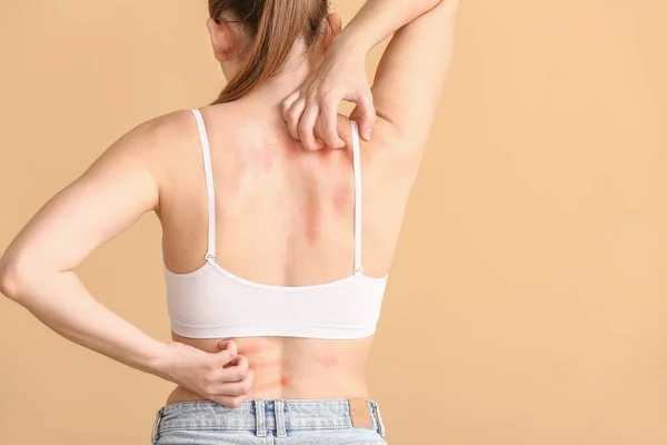 Ung Allergisk Kvinna Repar Sin Hud Mot Färg Bakgrund — Stockfoto