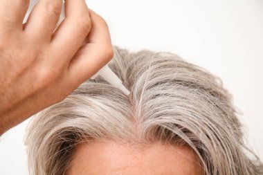 Kıdemli adam saç dökülmesi tedavisi için serum kullanıyor, yakın plan.