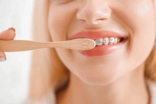 Giovane Donna Con Apparecchio Dentale Spazzolino Denti Legno Sfondo Bianco — Foto Stock