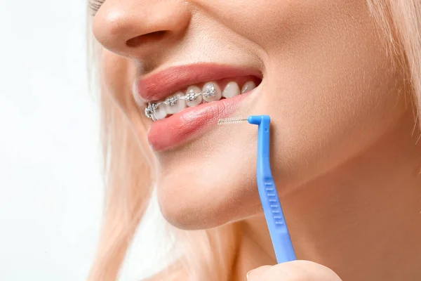 Young Woman Dental Braces Toothbrush White Background — Stock Photo, Image
