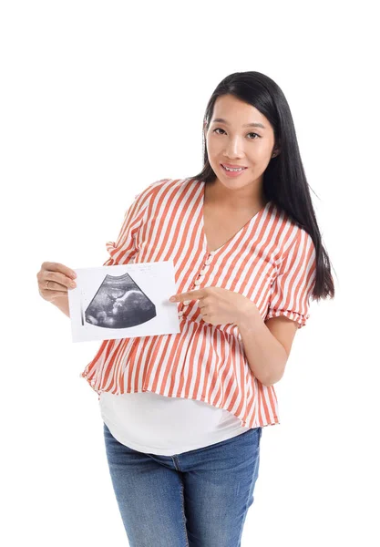 Pregnant Asian Woman Sonogram Image White Background — Stock Photo, Image