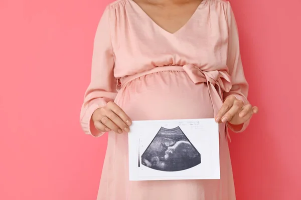 Mujer Joven Embarazada Con Imagen Ecografía Sobre Fondo Color — Foto de Stock