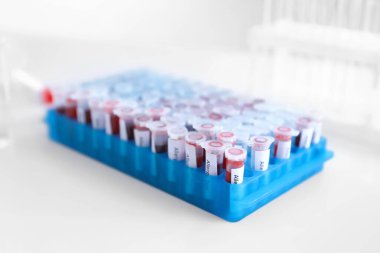 Laboratuvardaki masadaki alerji testleri.