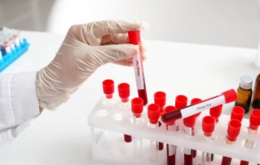 Laboratuvarda alerji testi olan bir doktor.