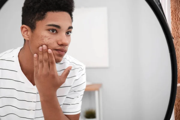 Afrikansk Amerikansk Teenage Dreng Med Acne Problem Derhjemme - Stock-foto