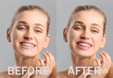 Gri arka planda dudaklarını büyütmeden önce ve sonra güzel bir genç kadın.