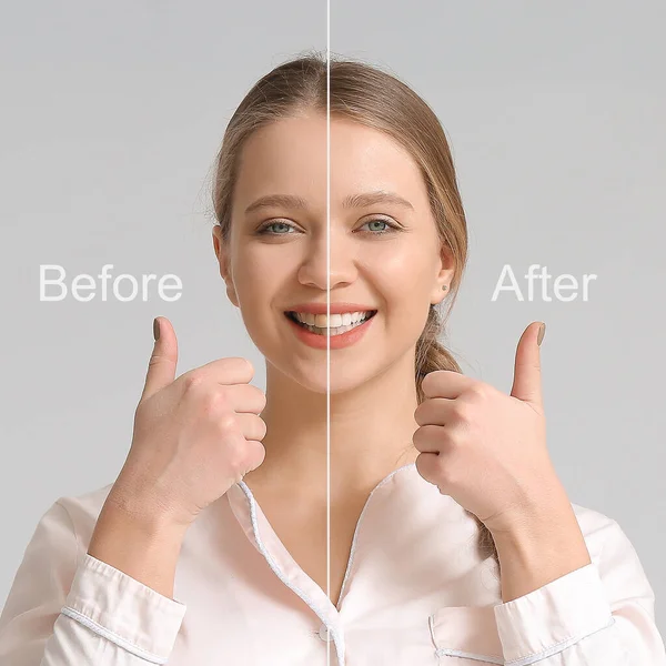Mooie Jonge Vrouw Voor Glimlach Makeover Procedure Grijze Achtergrond — Stockfoto