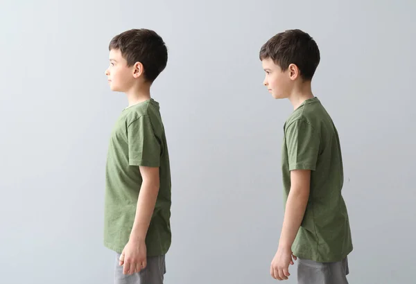 Little Boy Proper Bad Posture Grey Background — Stock Photo, Image