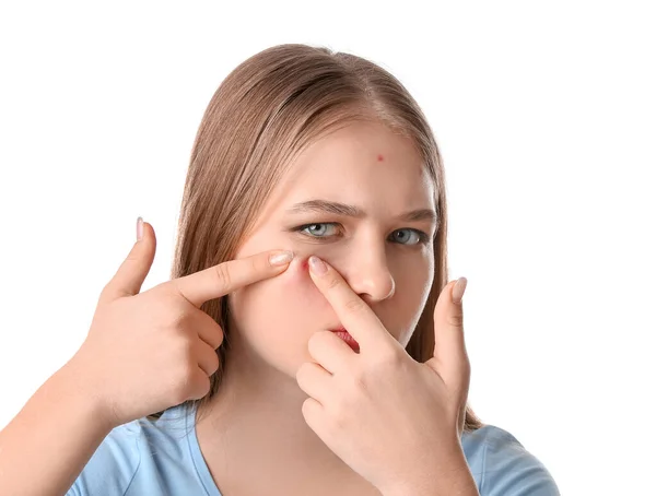 Teenage Girl Acne Problem White Background — Stock Photo, Image