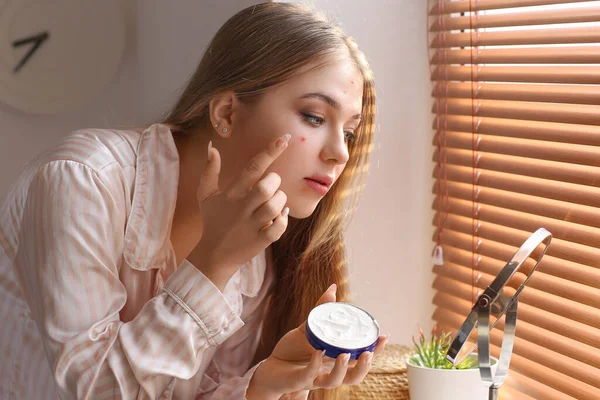 Teenage Girl Applying Remedy Acne Home — Stock Photo, Image