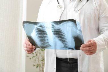 Klinikte ciğerlerinin röntgen görüntüsü olan kıdemli doktor.