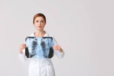 Gri arka planda akciğer röntgeni olan kadın doktor.