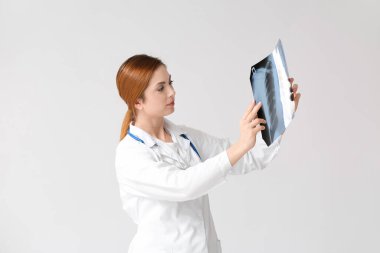 Gri arka planda akciğer röntgeni olan kadın doktor.