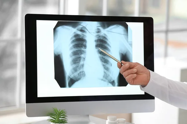 Pulmonologist Pointing Ray Image Lungs Clinic — Stock Photo, Image