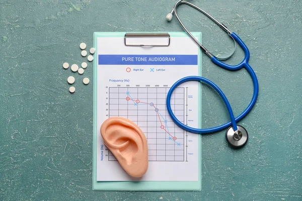 Audiogram, pills, stethoscope and ear model on color background
