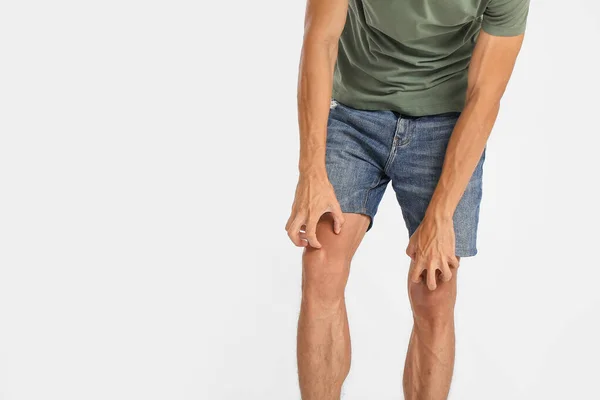 Young Man Scratching Himself Light Background — Stock Photo, Image