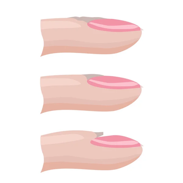 Structure Ongle Les Types Cuticules Ongle Soin Des Ongles Vecteur — Image vectorielle